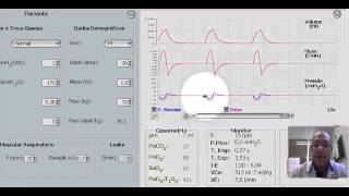Instalação da Insuficiência Respiratória Aguda  Crise de broncoespasmo 1 de 4 [upl. by Gorlicki]