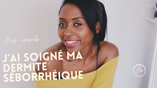 Comment jai soigné ma dermite séborrhéique [upl. by Divadnoj]