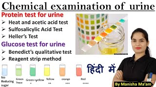 Urine Examination Part2 Chemical examination of urine  Urinalysis in hindi  Examination of urine [upl. by Ev463]