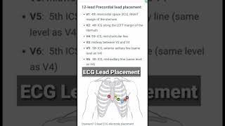 ECG Lead Placement Correct Position [upl. by Neelyhtak774]