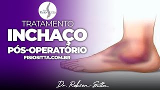 EDEMA INCHAÇO PÓS TRAUMA FRATURA IMOBILIZAÇÃO CONTUSÃO Clínica de Fisioterapia Dr Robson Sitta [upl. by Annoyt]