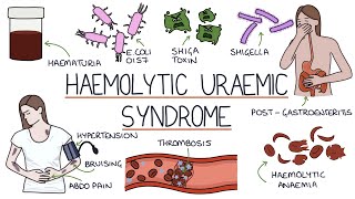 Haemolytic Uraemic Syndrome [upl. by Siraf]