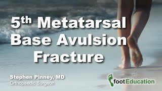 5th Metatarsal Base Avulsion Fracture [upl. by Bonis]