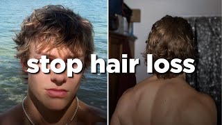 How to ACTUALLY stop hair loss as a guy [upl. by Einnahc]