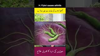 WARNING H Pylori Infection Could Be CAUSING Your Arthritis arthritis hpylori guthealth [upl. by Motch]