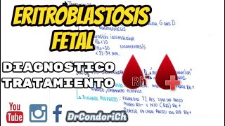 Eritroblastosis Fetal  Diagnostivo y Tratamiento  Incompatibilidad Saguinea [upl. by Latisha53]