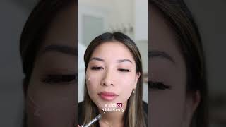 Facial balancing using dermal fillers dermalfillers filler fillers facialaesthetics botox [upl. by Aikyn]