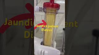 Jondice patient का डायलिसिस होने के बाद कैसे हो जाती है dialyzer dialysis kaise hota haidialysis [upl. by Rosenbaum784]