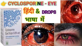 cyclosporine eye drops uses in hindiCyclosporine eye dropsdrops use drop tabletsuseviralvideo [upl. by Lacsap142]