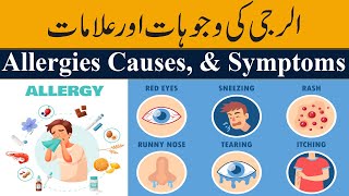 What is Allergy  Causes Signs and Symptoms Must Watch [upl. by Artamas]