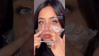 Blackheads remove hack😱✅face😱 clinicyoutubeshorts blackhadeads rremove facemakeup [upl. by Allecsirp]