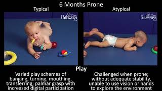 6 Month Old Baby Typical amp Atypical Development Side by Side [upl. by Teece]