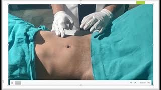 2 Abdominal Examination [upl. by Enaej]