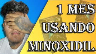 1 MES USANDO MINOXIDIL DE FARMACIAS SIMILARES SIENDO LAMPIÑO 🧔🏽‍♂️🤷🏽‍♂️ [upl. by Enitsed]