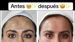 Antes y después de Tixel 🤩✨ [upl. by Fran]