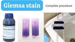 Giemsa Stain Procedure for Blood SmearHow to do Giemsa StainGiemsa Staining ProcedureAdnanMLT [upl. by Yggep199]