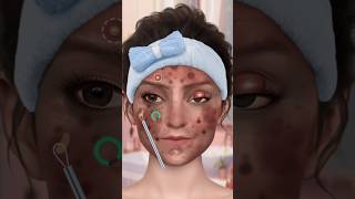 Face Treatment asmr asmrvideo asmreating asmreating [upl. by Malvie]