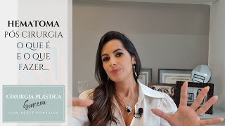 HEMATOMA pós cirurgia o que é e o que fazer [upl. by Anitsyrc298]