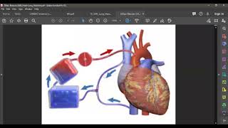 Acute pulmonary edema 1 [upl. by Dloreg]