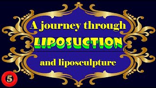 A journey through liposuction and liposculpture Part 510 [upl. by Ahsinroc]