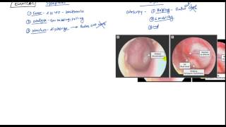 Acute Otitis Media and Otitis Media with Effusion for USMLE Step 2 [upl. by Ativad64]