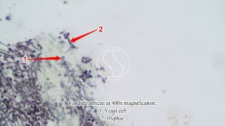 Candida albicans under the microscope with Gomoris Methenamine Silver GMS stain [upl. by Previdi724]