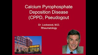 10 Calcium Pyrophosphate Deposition Disease Pseudogout [upl. by Sotos]