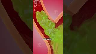 How acid reflux happens 🥵 Acidity and gas problem  GERD shorts viralvideo  creativelearning3d [upl. by Adala]