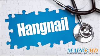 Hangnail ¦ Treatment and Symptoms [upl. by Dopp917]