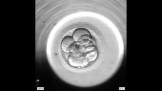 FIV  Vue au microscope du développement embryonnaire [upl. by Aihtnys]