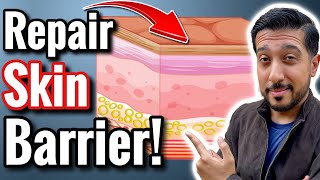 Fix a Damaged Skin Barrier  How to REPAIR Skin Barrier Function [upl. by Kermie980]