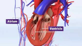 Atrial Fibrillation Animation Explained AFib amp Risk of Stroke [upl. by Ethelstan]