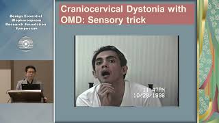 Oromandibular Dystonia and Meige Syndrome Virgilio Gerald H Evidente MD [upl. by Radford]