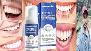 Smart Drops Teeth Whitening Foam Toothpaste  Honest Review [upl. by Ahsienahs270]