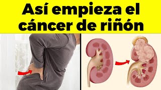 Así Empieza EL CÁNCER DE RIÑON Y Nadie Tiene Cuidado  Signos Y Síntomas de Cáncer Que Debes Conocer [upl. by Arahsat640]