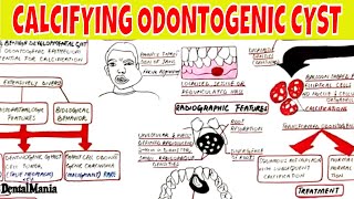 Calcifying Odontogenic Cyst  Clinical radiographic Histopathologic Features and Treatment [upl. by Arrekahs461]