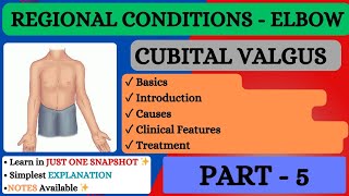 CUBITAL VALGUS ll Regional Conditions  Elbow ll Clinical Orthopaedics ll Part  5✨ [upl. by Aserret]