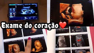 ECOCARDIOGRAMA FETAL  27 SEMANAS VIMOS O ROSTINHO DO ROMEO [upl. by Oidale]