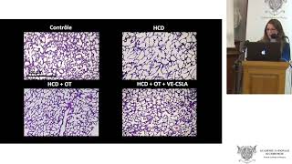 Les vésicules extracellulaire de cellules souches [upl. by Tacye]