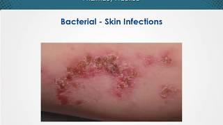 Bacterial skin infections  Dermatology  EduRx [upl. by Eneleh791]