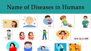 List of Most Common Diseases Vocabulary In English  Name of Diseases in Humans [upl. by Eilsel]