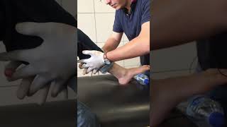 Squeeze Test  Ankle [upl. by Elletse]