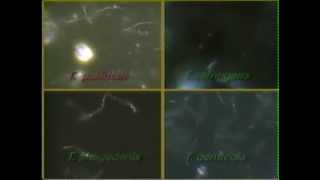 Treponema Syphilis Darkfield Video CDC [upl. by Va]