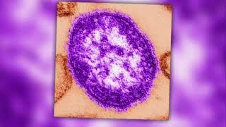 Health department warns of measles outbreak in Philadelphia [upl. by Nelli772]