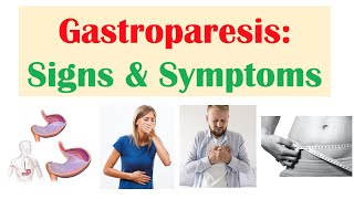 Gastroparesis Signs amp Symptoms ex Nausea Abdominal Pain Weight Loss [upl. by Annahsohs]