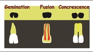 Fusion Gemination amp Concrescence [upl. by Barbie799]