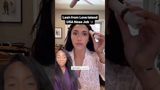 Leah from Love Island USA is so honest about her Nose Job 🏝️ loveislandusa [upl. by Nanor]