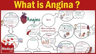 Pharmacology  What is Angina Pectoris  Types of Angina Symptoms Causes ampTreatment FROM A TO Z [upl. by Olivette706]