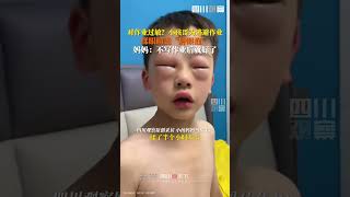 小孩哥为逃作业上演苦肉计，揉眼睛变“肿眼泡”，妈妈：不写作业一会儿就缓解了！shorts [upl. by Greenquist369]