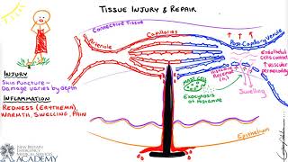 Tissue Injury amp Repair [upl. by Harland]